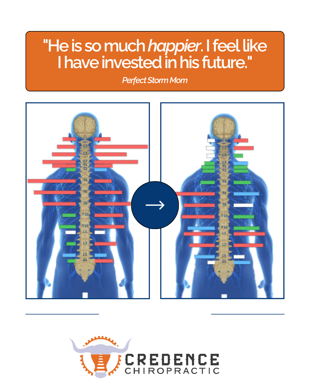 The Hidden Truth About Autism Levels Your Doctor Won't Tell You